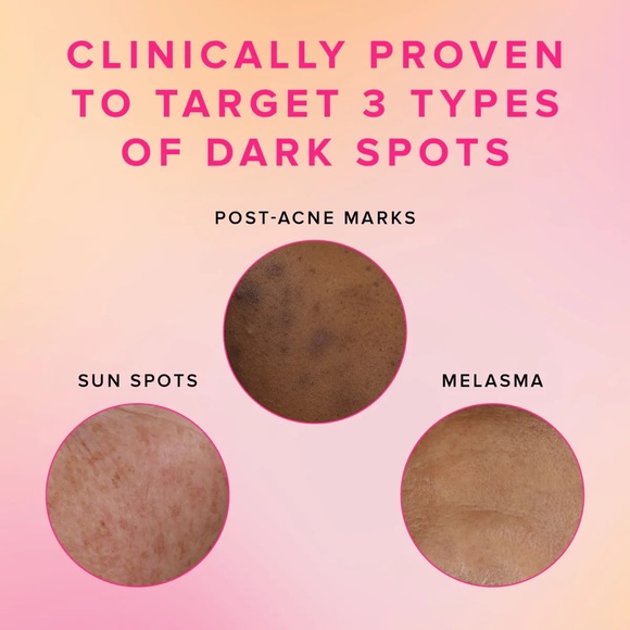 NEW Farmacy Brighten Up 3% TXA Dark Spot Toner with Azelaic Acid+PHA - Picture 2 of 6